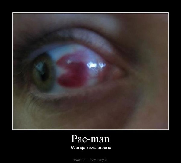 Pac-man –  Wersja rozszerzona 