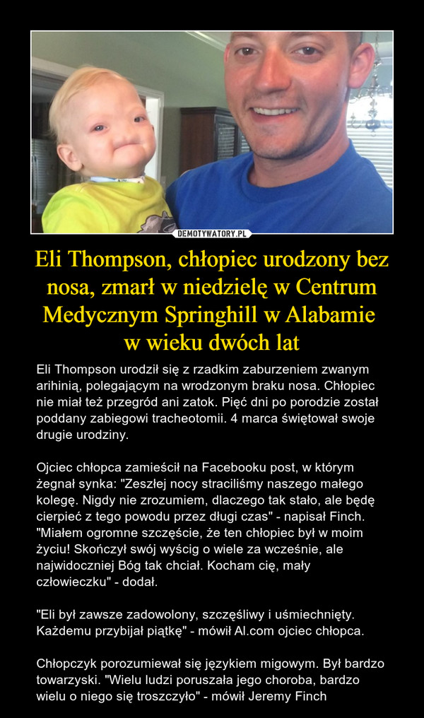Eli Thompson, chłopiec urodzony bez nosa, zmarł w niedzielę w Centrum Medycznym Springhill w Alabamie w wieku dwóch lat – Eli Thompson urodził się z rzadkim zaburzeniem zwanym arihinią, polegającym na wrodzonym braku nosa. Chłopiec nie miał też przegród ani zatok. Pięć dni po porodzie został poddany zabiegowi tracheotomii. 4 marca świętował swoje drugie urodziny. Ojciec chłopca zamieścił na Facebooku post, w którym żegnał synka: "Zeszłej nocy straciliśmy naszego małego kolegę. Nigdy nie zrozumiem, dlaczego tak stało, ale będę cierpieć z tego powodu przez długi czas" - napisał Finch. "Miałem ogromne szczęście, że ten chłopiec był w moim życiu! Skończył swój wyścig o wiele za wcześnie, ale najwidoczniej Bóg tak chciał. Kocham cię, mały człowieczku" - dodał.  "Eli był zawsze zadowolony, szczęśliwy i uśmiechnięty. Każdemu przybijał piątkę" - mówił Al.com ojciec chłopca. Chłopczyk porozumiewał się językiem migowym. Był bardzo towarzyski. "Wielu ludzi poruszała jego choroba, bardzo wielu o niego się troszczyło" - mówił Jeremy Finch 