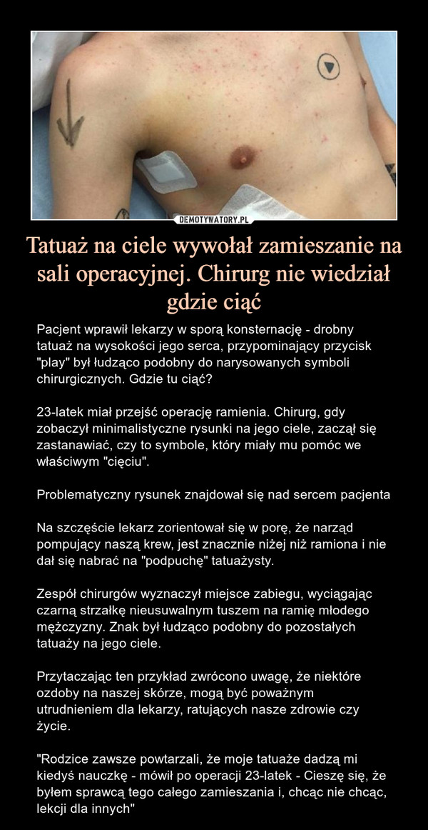 Tatuaż na ciele wywołał zamieszanie na sali operacyjnej. Chirurg nie wiedział gdzie ciąć – Pacjent wprawił lekarzy w sporą konsternację - drobny tatuaż na wysokości jego serca, przypominający przycisk "play" był łudząco podobny do narysowanych symboli chirurgicznych. Gdzie tu ciąć?23-latek miał przejść operację ramienia. Chirurg, gdy zobaczył minimalistyczne rysunki na jego ciele, zaczął się zastanawiać, czy to symbole, który miały mu pomóc we właściwym "cięciu".Problematyczny rysunek znajdował się nad sercem pacjentaNa szczęście lekarz zorientował się w porę, że narząd pompujący naszą krew, jest znacznie niżej niż ramiona i nie dał się nabrać na "podpuchę" tatuażysty.Zespół chirurgów wyznaczył miejsce zabiegu, wyciągając czarną strzałkę nieusuwalnym tuszem na ramię młodego mężczyzny. Znak był łudząco podobny do pozostałych tatuaży na jego ciele. Przytaczając ten przykład zwrócono uwagę, że niektóre ozdoby na naszej skórze, mogą być poważnym utrudnieniem dla lekarzy, ratujących nasze zdrowie czy życie."Rodzice zawsze powtarzali, że moje tatuaże dadzą mi kiedyś nauczkę - mówił po operacji 23-latek - Cieszę się, że byłem sprawcą tego całego zamieszania i, chcąc nie chcąc, lekcji dla innych" 